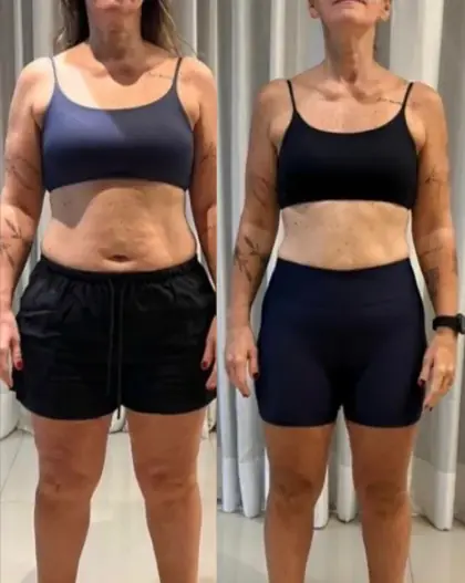 Evolução 4